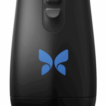 Image du Butterfly iQ3, échographe ultra-portable compact, branché à une tablette avec affichage d’image échographique. Compatible iOS et Android.