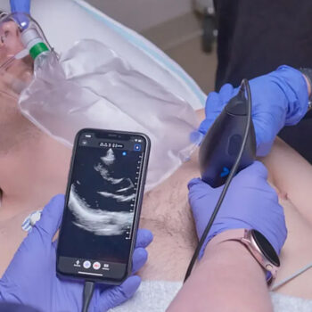 Utilisation cardiologie - Echographe portable Butterfly iQ+