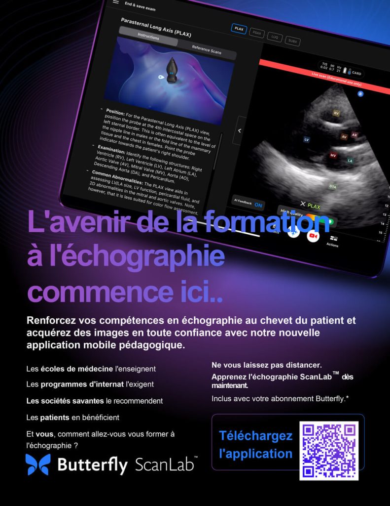 Formation échographie portable Butterfly ScanLab — apprentissage POCUS sur mobile