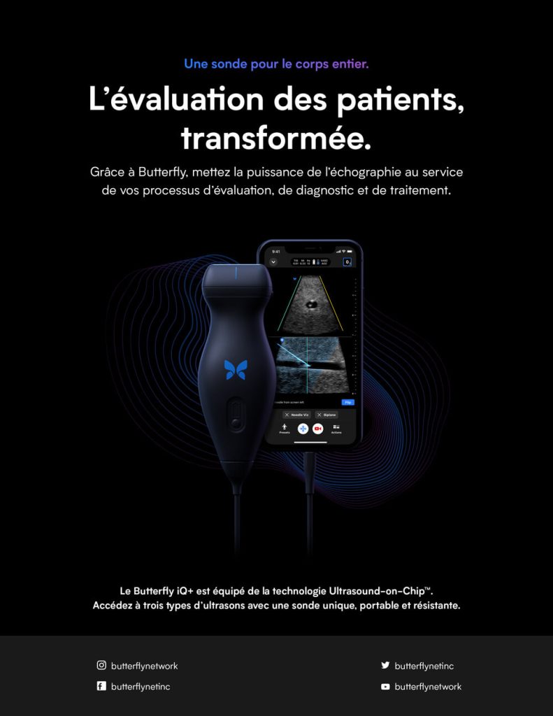 Brochure Butterfly iQ+ — échographe portable polyvalent avec Ultrasound-on-Chip